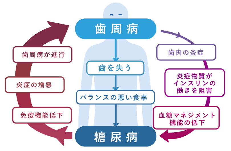 歯周病と糖尿病の関係図
